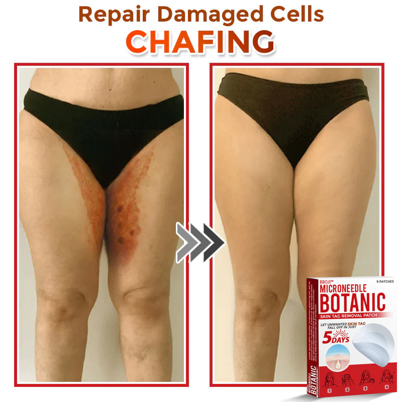 BBOJI™ MicroNeedle Botanic Skin Tag Removal Patch 🇺🇸 Made in the USA
