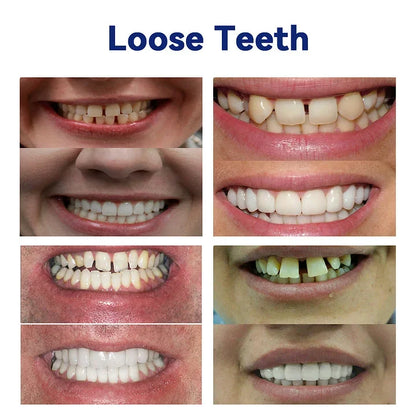 NESLEMY™-🦷Advanced Customized Full Denture Set – For a Perfect Smile and Natural Comfort🥰( 🔥Last Day Promotion🔥）