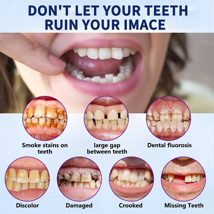 NESLEMY™-🦷Advanced Customized Full Denture Set – For a Perfect Smile and Natural Comfort🥰( 🔥Last Day Promotion🔥）