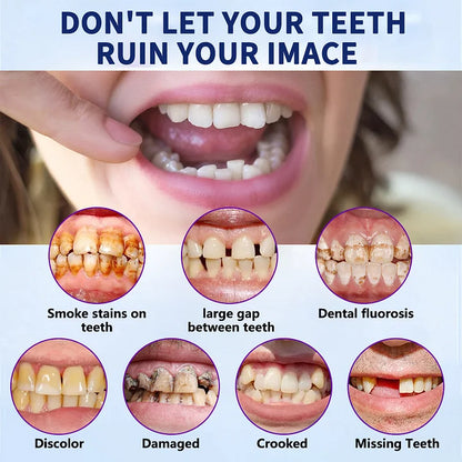 NESLEMY™-🦷Advanced Customized Full Denture Set – For a Perfect Smile and Natural Comfort🥰( 🔥Last Day Promotion🔥）