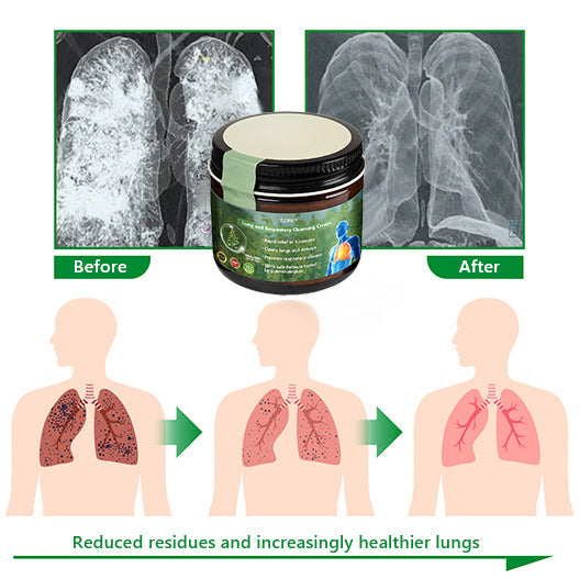 Official Store：LOVILDS™ Mullein Clear Lung Repair Cream 💥💥- endorsed by the British Thoracic Society to support lung health👑