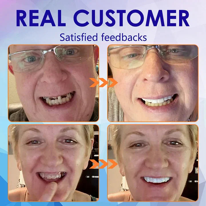 NESLEMY™-🦷Advanced Customized Full Denture Set – For a Perfect Smile and Natural Comfort🥰( 🔥Last Day Promotion🔥）