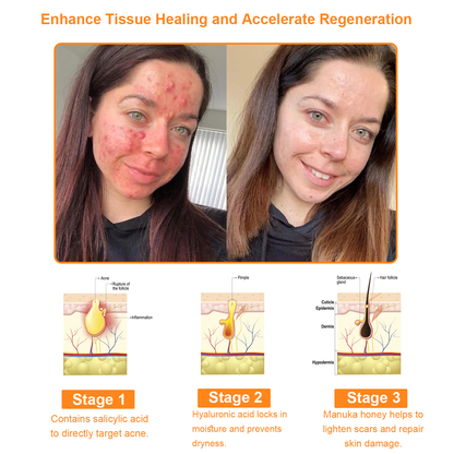 BBOJI™ 7-Day Multi-Effect All-in-One Skincare Cream (👨‍⚕️AAD Recommended)🔥🔥