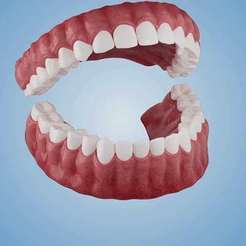 NESLEMY™-🦷Advanced Customized Full Denture Set – For a Perfect Smile and Natural Comfort🥰( 🔥Last Day Promotion🔥）
