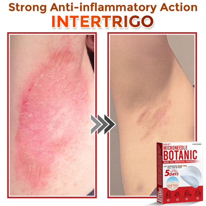 BBOJI™  MicroNeedle Botanic Skin Tag Removal Patch 🇺🇸 Made in the USA