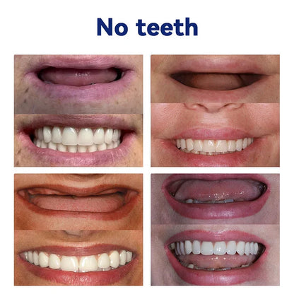NESLEMY™-🦷Advanced Customized Full Denture Set – For a Perfect Smile and Natural Comfort🥰( 🔥Last Day Promotion🔥）