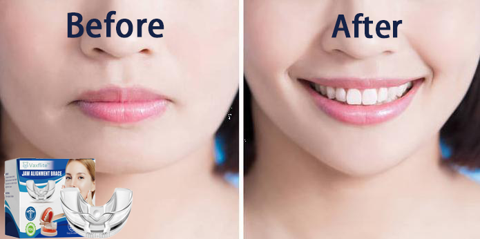 š„Vaxfliteā¢Mandibular Corrector-For a Healthier, More Aligned Smileš¦·š„