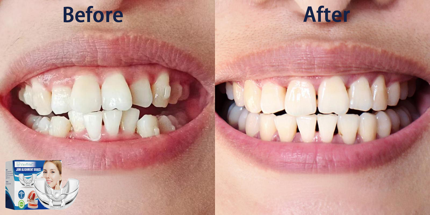 š„Vaxfliteā¢Mandibular Corrector-For a Healthier, More Aligned Smileš¦·š„